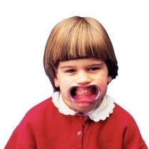 428-605455 Spandex Cheek Retractor -Child