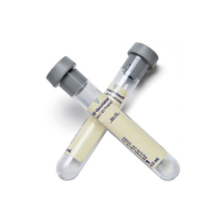 BD364953 VACUTAINER KIT URINE TRANSFER 13x 75 4.0 C&S GR