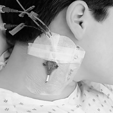 EM-6330-1650 Transparent Dressing, 4" x 6 1/8"