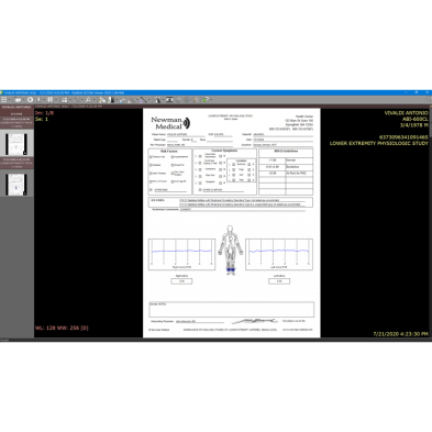EM-9499-SFTW Newman DICOM Software Integration Full worklist capability
