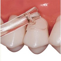 Premier Cure Thru Cervical Matrices Assorted (250)
