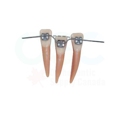 .016 x .022 Upper Titanol Super Elastic Shape 2 (10/Pack) - OSC
