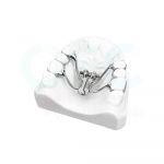 Ragno Fan-Type Rapid Expander 9mm