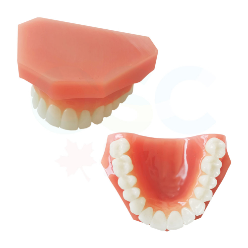Class I Ideal Arch Model Upper ONLY - OSC
