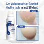 Footlogix #3+ Cracked Heel Formula Mousse 4.23 oz. 04131