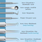 8Pcs Stainless Steel Blackhead Removal Tool Set 30320