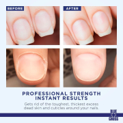 Blue+Cross Cuticle Remover Cream 4 fl oz /118 ml #204  71239