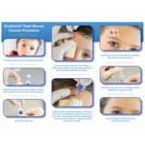 GluStitch&reg; Twist Tissue Adhesive, Sterile, 12 x 0.5 mL