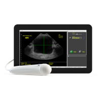 Interson ViewBladder 10
