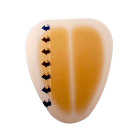 DynaDerm - Hydrocolloid Dressing - Sacral