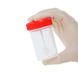 Stool Specimen Container with Spoon, Sterile