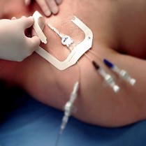 Tegaderm HP Trans. Film Dressing 2 3/8" x 2 3/8" 100/bx