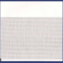 Quest/Eclipse Plus/Atria EKG Paper